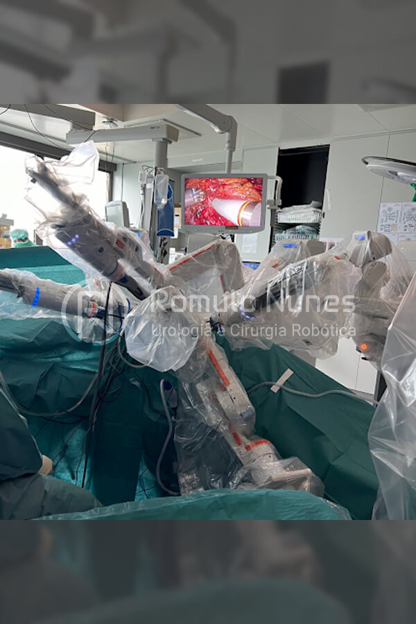 Braço do robô posicionado durante a cirurgia