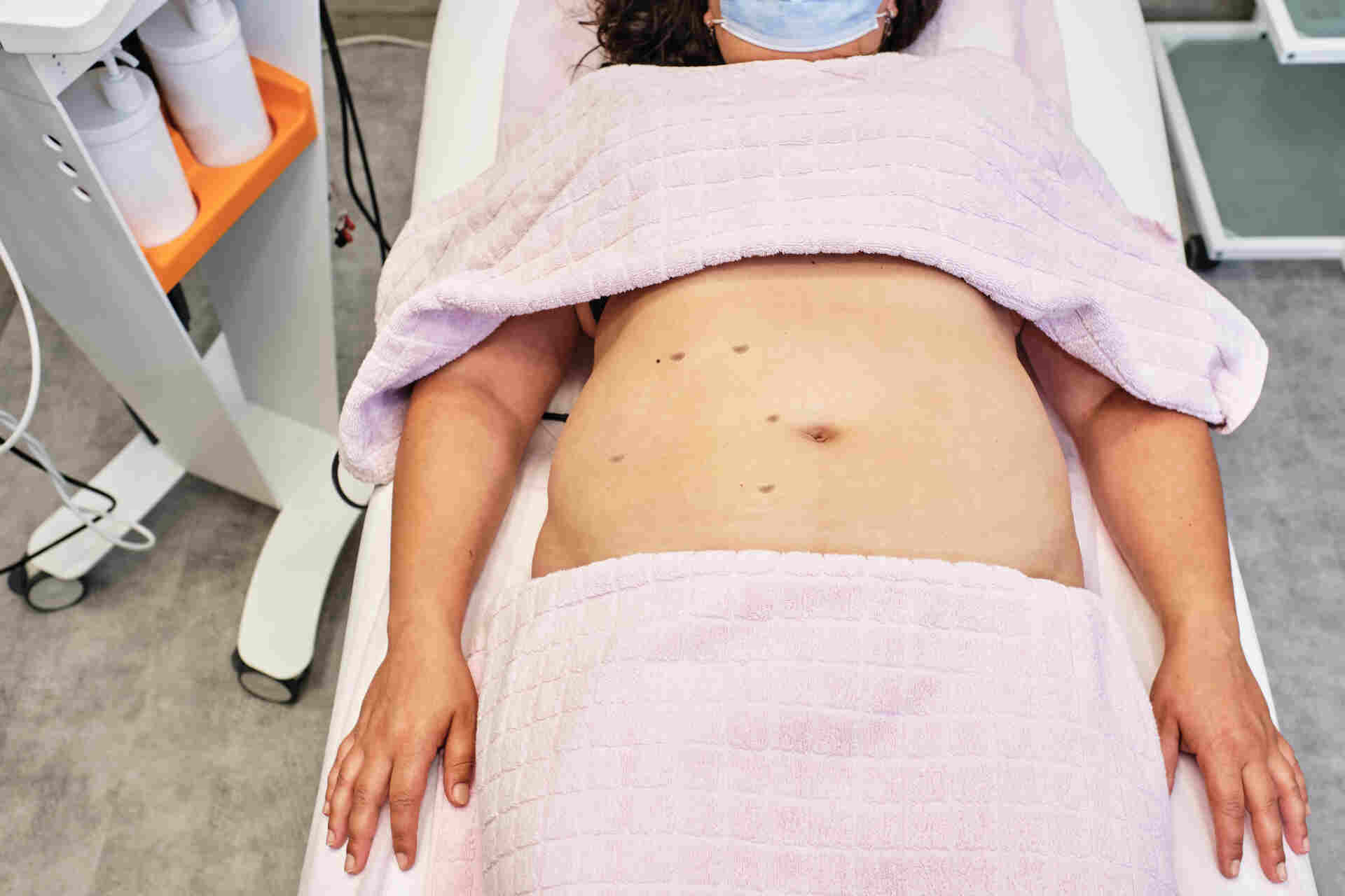 Cicatrização dos acessos de incisoes de cirurgia robótica