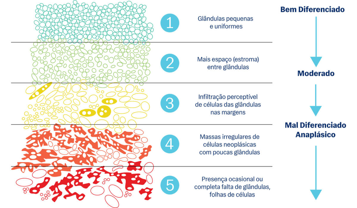 Nódulo Renal