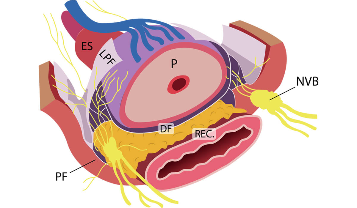 Nódulo Renal