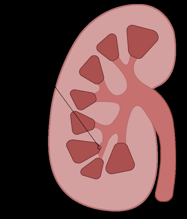 Papila Renal, lugar onde o cálculo renal é formado